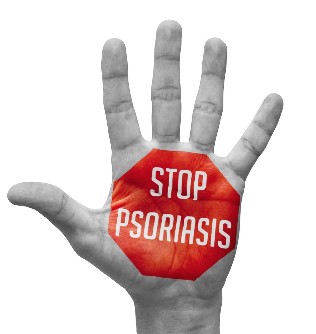 Prevention of psoriasis